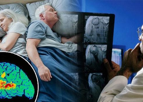 What Sleep Disorders Are Common in People With Dementia?