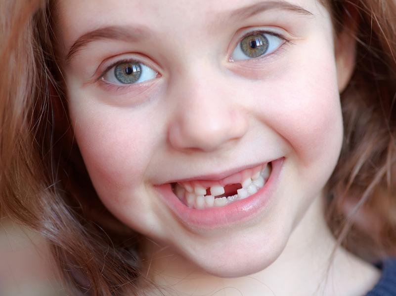 What If My Child Loses Their Baby Teeth Too Early? - Black & Bass Cosmetic and Family Dentistry - Dr. Kevin Bass and Dr. Lawrence Black