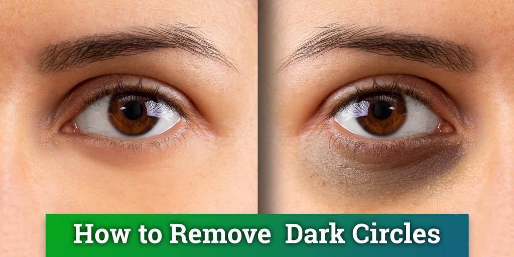 Dark circles under eyes