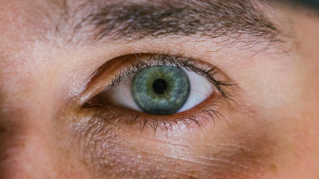 7 Ways to Get Rid of Dark Circles Under Your Eyes -